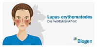 Lupus erythematodes: Wie Covid-19 das Leben von Betroffenen zusätzlich erschwert